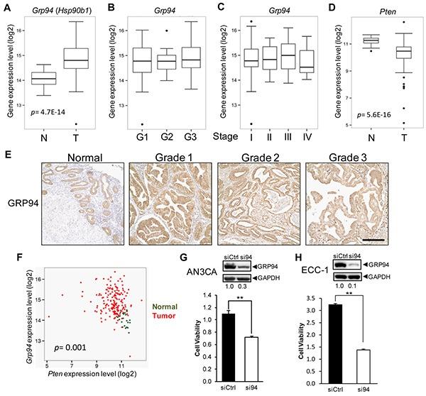 https://cdn.ncbi.nlm.nih.gov/pmc/blobs/0954/4924759/4dcf39f06c65/oncotarget-07-14885-g001.jpg
