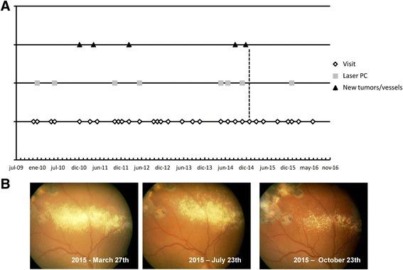 https://cdn.ncbi.nlm.nih.gov/pmc/blobs/0957/5492903/8c35dffcbfe1/13023_2017_664_Fig1_HTML.jpg