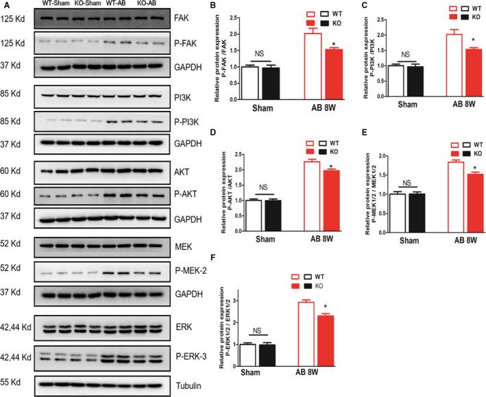 https://cdn.ncbi.nlm.nih.gov/pmc/blobs/0958/7660778/258b68cfcdfc/JAH3-9-e015307-g005.jpg