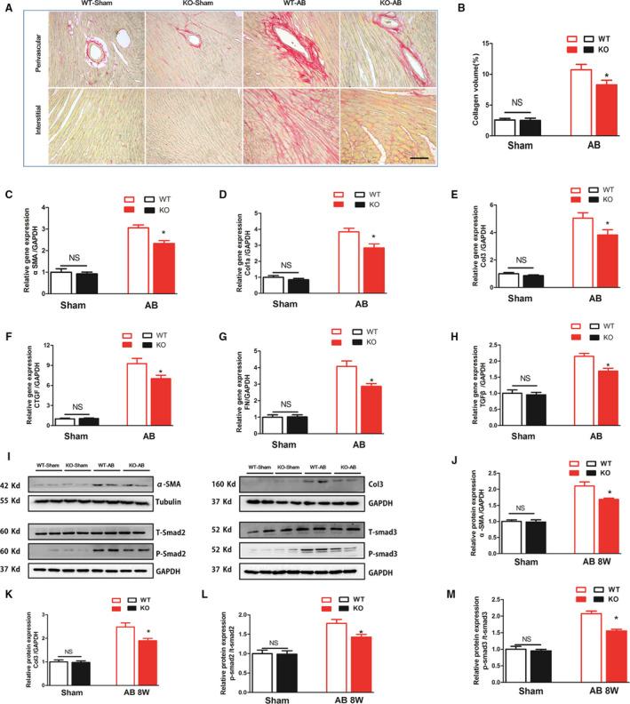 https://cdn.ncbi.nlm.nih.gov/pmc/blobs/0958/7660778/56c76a9902ee/JAH3-9-e015307-g004.jpg