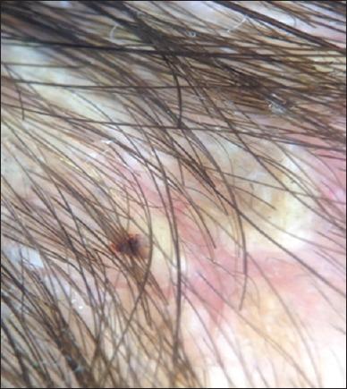 https://cdn.ncbi.nlm.nih.gov/pmc/blobs/095a/6192235/3cd292813de8/IJT-10-154-g005.jpg