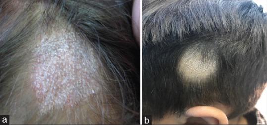 https://cdn.ncbi.nlm.nih.gov/pmc/blobs/095a/6192235/d16546bde153/IJT-10-154-g001.jpg