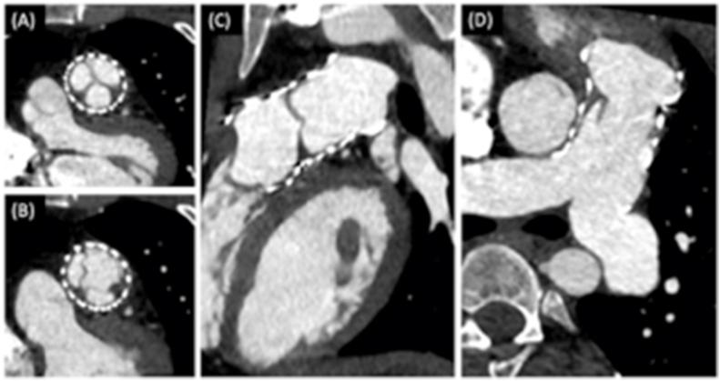 https://cdn.ncbi.nlm.nih.gov/pmc/blobs/095c/12355537/0d2b39622c32/gr4.jpg