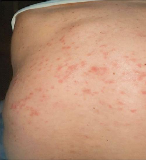 https://cdn.ncbi.nlm.nih.gov/pmc/blobs/0964/12172424/734acd374e8b/dr-17-2-10143-g003.jpg