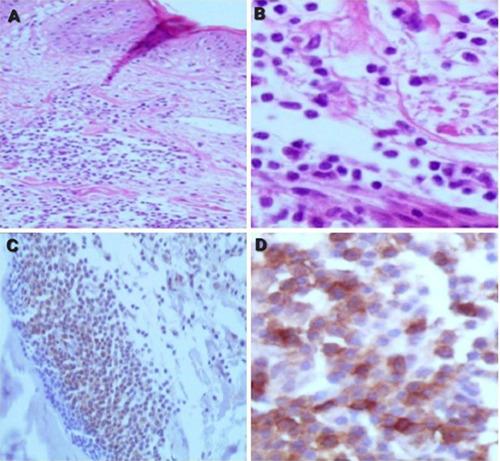 https://cdn.ncbi.nlm.nih.gov/pmc/blobs/0964/12172424/8562e1ae8296/dr-17-2-10143-g002.jpg