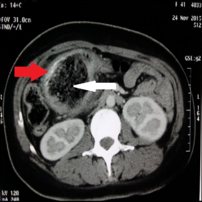 https://cdn.ncbi.nlm.nih.gov/pmc/blobs/096a/11215090/b321816e52ed/gr3.jpg