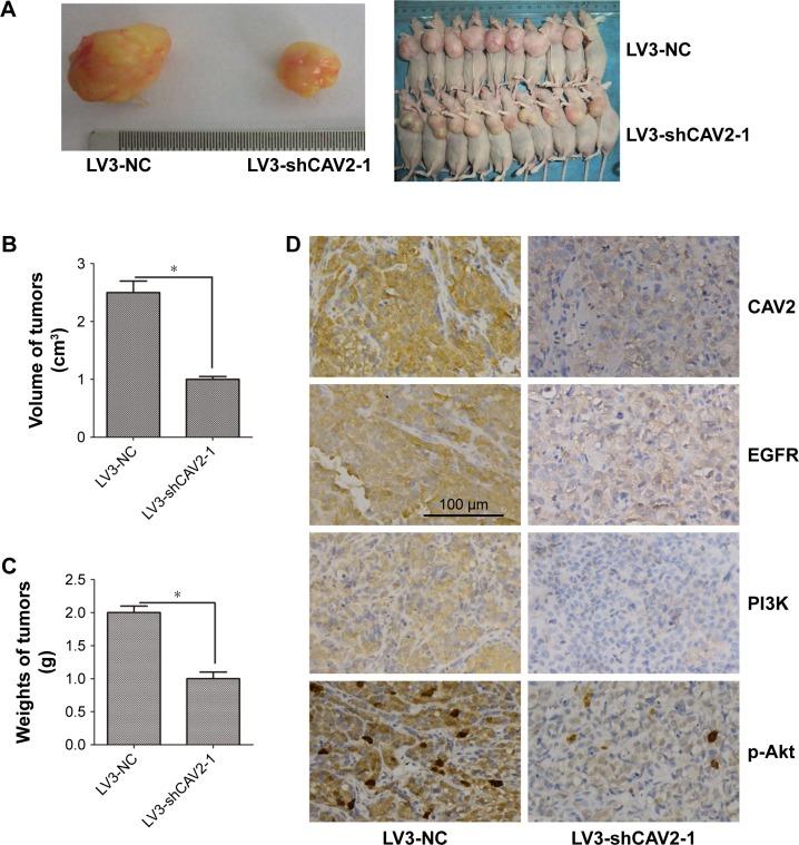 https://cdn.ncbi.nlm.nih.gov/pmc/blobs/096a/6163017/88e7f3399dfb/ott-11-6209Fig5.jpg