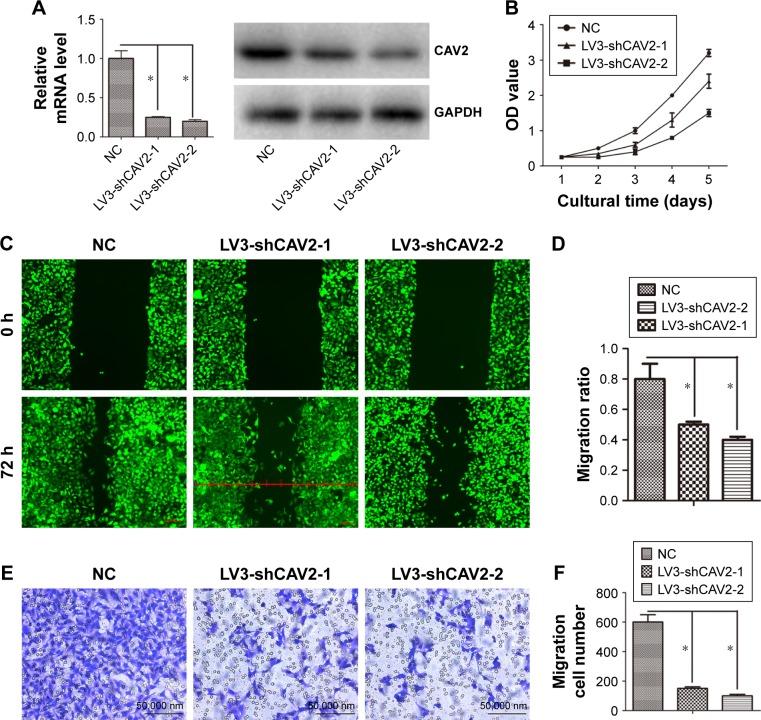 https://cdn.ncbi.nlm.nih.gov/pmc/blobs/096a/6163017/ec2b6856ff3a/ott-11-6209Fig3.jpg
