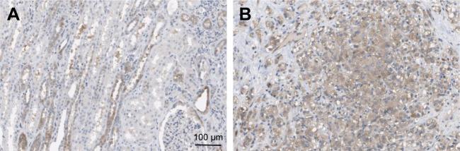 https://cdn.ncbi.nlm.nih.gov/pmc/blobs/096a/6163017/f5dc7fd90f09/ott-11-6209Fig2.jpg