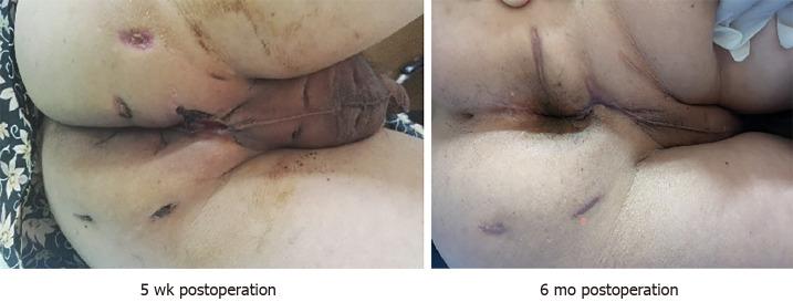 https://cdn.ncbi.nlm.nih.gov/pmc/blobs/096f/8554422/22e34e054b27/WJCC-9-8537-g006.jpg