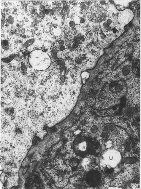 https://cdn.ncbi.nlm.nih.gov/pmc/blobs/0971/1257145/cf2de2c4da6e/janat00039-0242-b.jpg