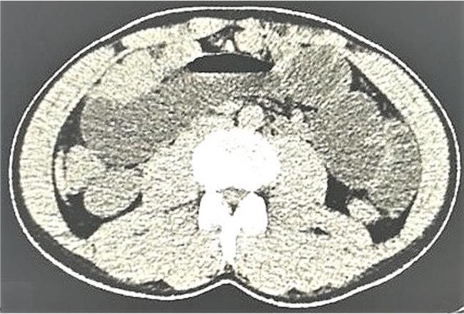 https://cdn.ncbi.nlm.nih.gov/pmc/blobs/0972/7026943/6369aaf0a95a/cln-75-e1489-g004.jpg