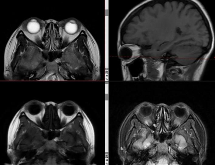 https://cdn.ncbi.nlm.nih.gov/pmc/blobs/0973/12380888/30a495899920/fonc-15-1619667-g006.jpg