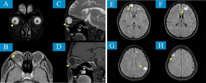 https://cdn.ncbi.nlm.nih.gov/pmc/blobs/0973/12380888/6f91989c4de9/fonc-15-1619667-g004.jpg