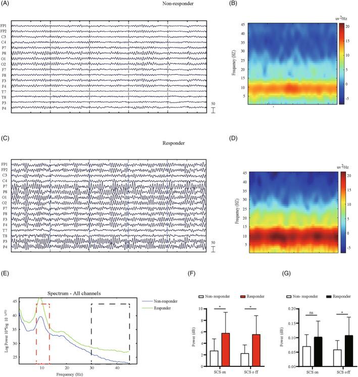 https://cdn.ncbi.nlm.nih.gov/pmc/blobs/0978/10791032/04f8779d7417/ACN3-11-57-g001.jpg