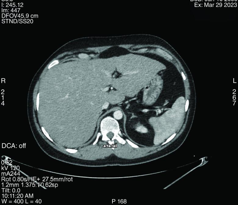 https://cdn.ncbi.nlm.nih.gov/pmc/blobs/097a/10518835/b6007840a4c2/fsoa-09-893-g1.jpg