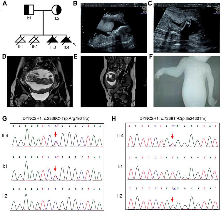 https://cdn.ncbi.nlm.nih.gov/pmc/blobs/0983/10116042/72656f56d340/fgene-14-1125473-g001.jpg