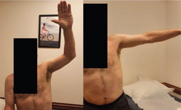 https://cdn.ncbi.nlm.nih.gov/pmc/blobs/0987/10308967/22a76b97c540/JOCR-13-52-g004.jpg