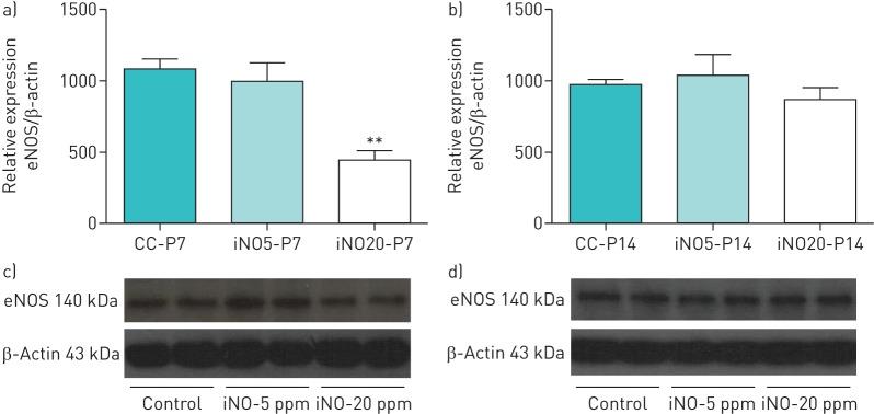 https://cdn.ncbi.nlm.nih.gov/pmc/blobs/0987/5005156/ec5343df1ed0/00060-2015.01.jpg
