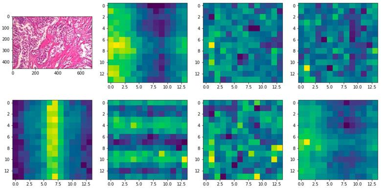 https://cdn.ncbi.nlm.nih.gov/pmc/blobs/0988/9139754/045ab1624307/diagnostics-12-01152-g010.jpg
