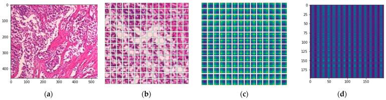 https://cdn.ncbi.nlm.nih.gov/pmc/blobs/0988/9139754/c166f71a315a/diagnostics-12-01152-g009.jpg