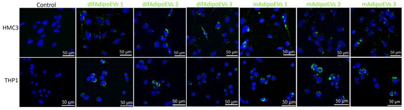 https://cdn.ncbi.nlm.nih.gov/pmc/blobs/098e/12153563/800c474e7c02/cells-14-00757-g007.jpg
