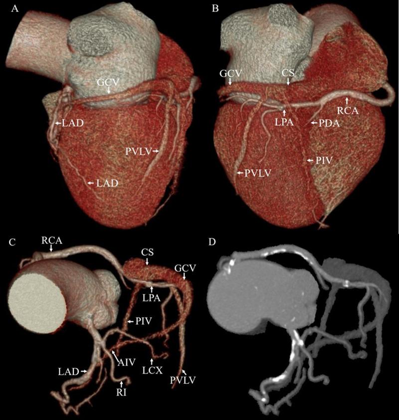 https://cdn.ncbi.nlm.nih.gov/pmc/blobs/0994/7673525/bdbd825a3e5f/pone.0242216.g003.jpg
