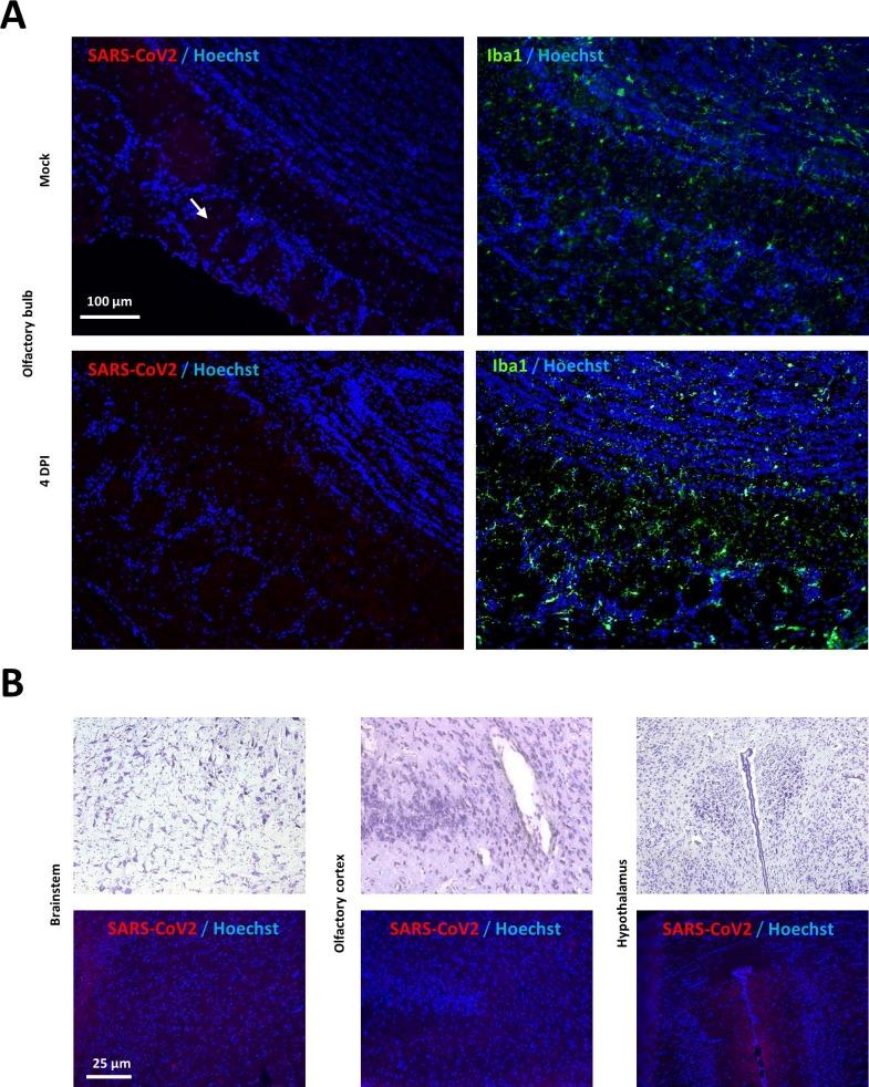 https://cdn.ncbi.nlm.nih.gov/pmc/blobs/0995/7332942/348b8feaa81a/fx3_lrg.jpg