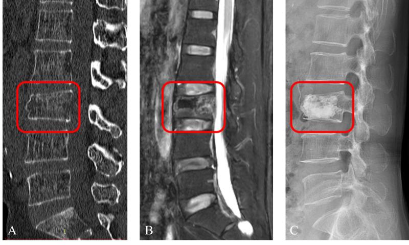 https://cdn.ncbi.nlm.nih.gov/pmc/blobs/099a/12396830/3c368004e9ad/medinform-v13-e75665-g006.jpg