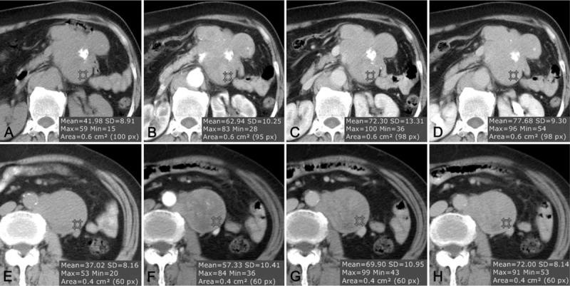 https://cdn.ncbi.nlm.nih.gov/pmc/blobs/099c/4706263/6ecf249cd3d8/medi-95-e2404-g006.jpg
