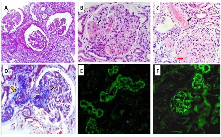 https://cdn.ncbi.nlm.nih.gov/pmc/blobs/09a7/12110287/9332cb67a461/diseases-13-00153-g001.jpg