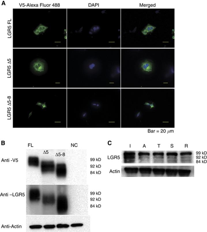 https://cdn.ncbi.nlm.nih.gov/pmc/blobs/09a8/4891500/991749be37ff/bjc2016112f2.jpg
