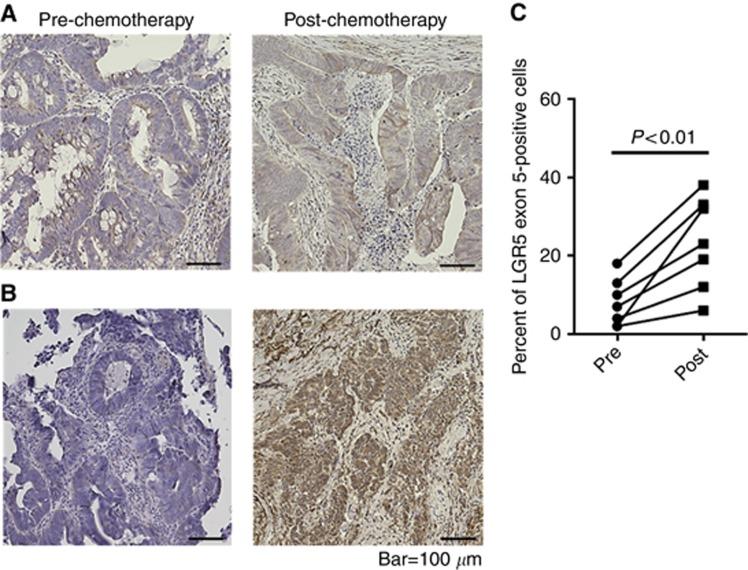 https://cdn.ncbi.nlm.nih.gov/pmc/blobs/09a8/4891500/b084c0aafaa9/bjc2016112f5.jpg