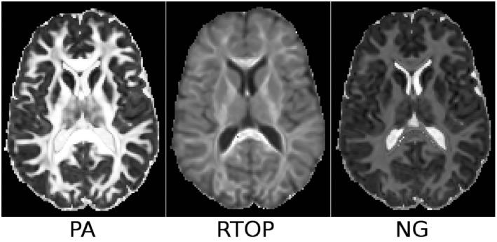 https://cdn.ncbi.nlm.nih.gov/pmc/blobs/09b4/6518940/39a5eda62c84/MRM-81-2774-g003.jpg