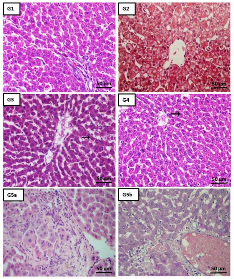 https://cdn.ncbi.nlm.nih.gov/pmc/blobs/09ba/8540501/c137fb7df0c6/ijms-22-11219-g005a.jpg