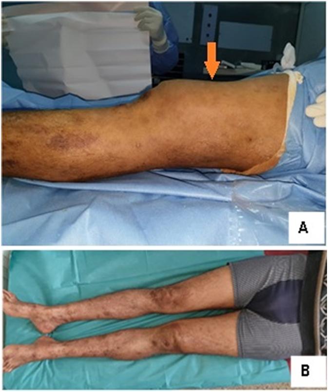 https://cdn.ncbi.nlm.nih.gov/pmc/blobs/09bf/8881491/9e3466ba6077/gr1.jpg