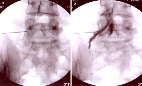 https://cdn.ncbi.nlm.nih.gov/pmc/blobs/09cf/2684150/9273b4b16a48/12178_2007_9003_Fig5_HTML.jpg