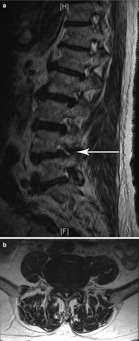 https://cdn.ncbi.nlm.nih.gov/pmc/blobs/09cf/2684150/987764101c00/12178_2007_9003_Fig2_HTML.jpg