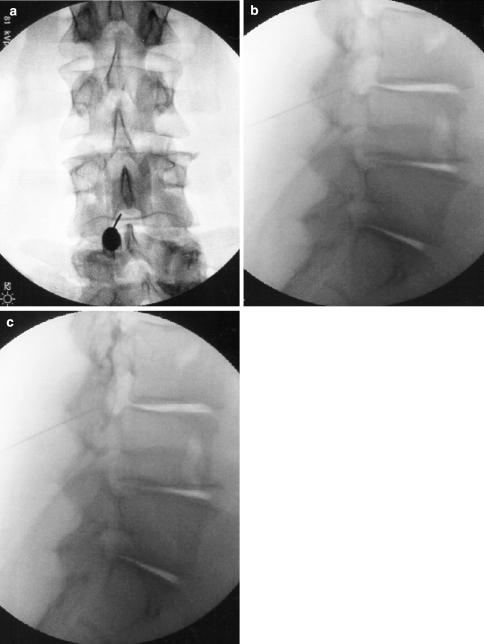 https://cdn.ncbi.nlm.nih.gov/pmc/blobs/09cf/2684150/f7775fd3ee70/12178_2007_9003_Fig3_HTML.jpg