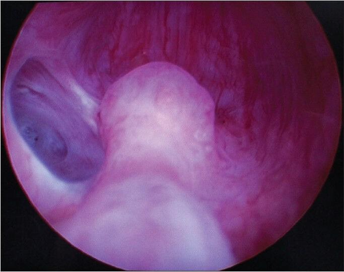 https://cdn.ncbi.nlm.nih.gov/pmc/blobs/09d4/4127870/e234e8f6d9c2/UA-6-261-g003.jpg