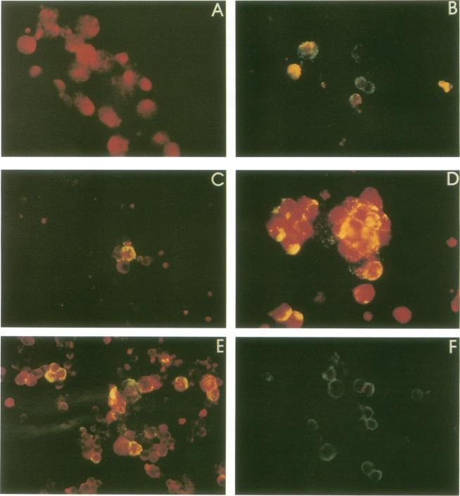 https://cdn.ncbi.nlm.nih.gov/pmc/blobs/09da/265471/d141de2f93d7/jcm00032-0301-a.jpg
