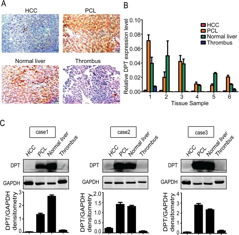 https://cdn.ncbi.nlm.nih.gov/pmc/blobs/09e1/4196157/322fb6f03525/oncotarget-05-6701-g002.jpg