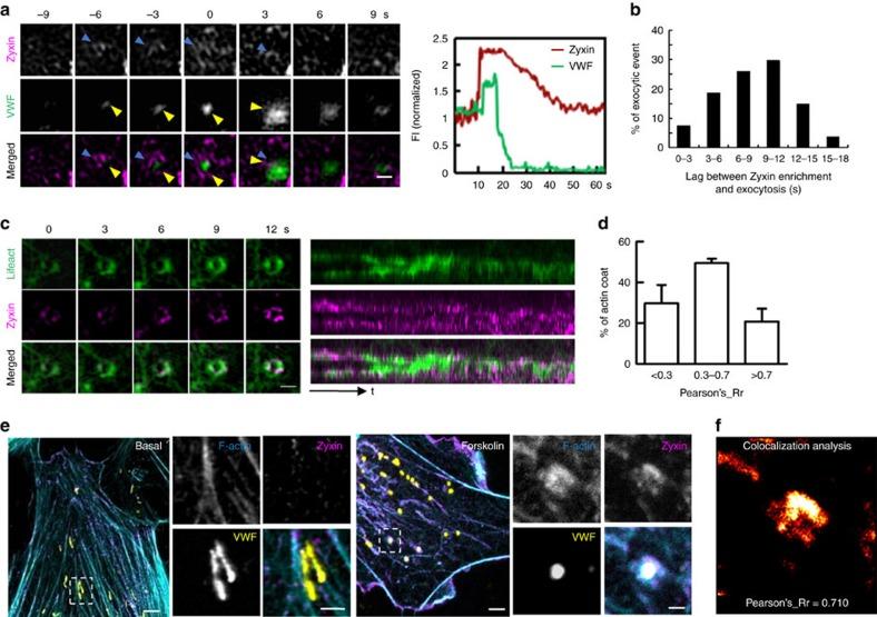 https://cdn.ncbi.nlm.nih.gov/pmc/blobs/09e2/5338022/d353b5e07c62/ncomms14639-f3.jpg