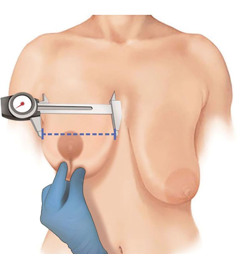 https://cdn.ncbi.nlm.nih.gov/pmc/blobs/09e2/9200382/92f2f9ae9e73/gox-10-e4349-g001.jpg
