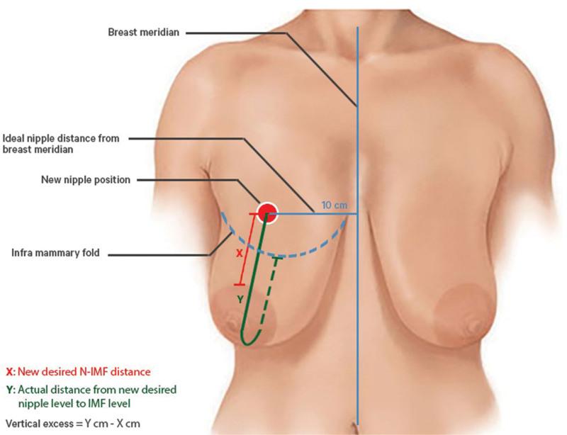 https://cdn.ncbi.nlm.nih.gov/pmc/blobs/09e2/9200382/c13e68439e45/gox-10-e4349-g002.jpg