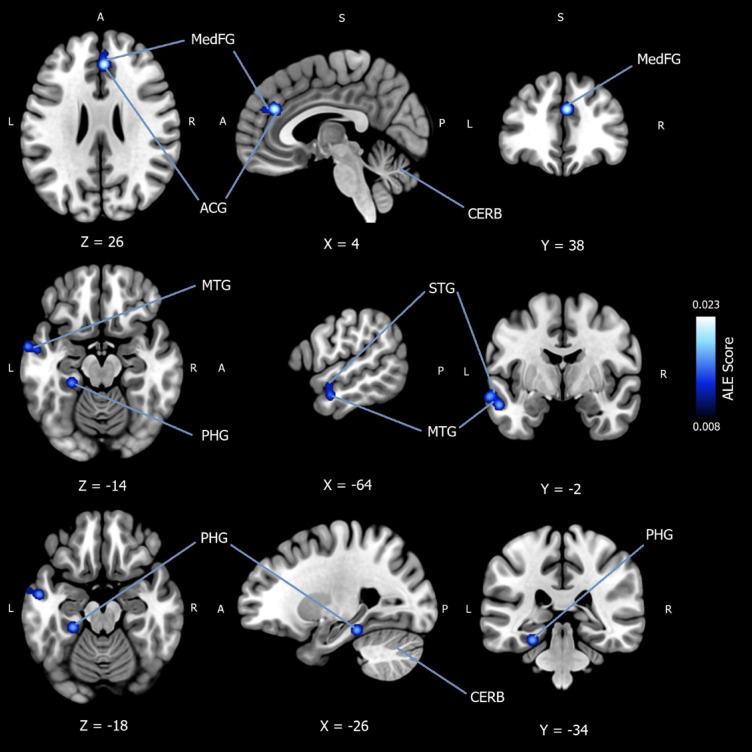 https://cdn.ncbi.nlm.nih.gov/pmc/blobs/09f2/12137648/234f01831802/41598_2025_3828_Fig3_HTML.jpg