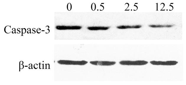 https://cdn.ncbi.nlm.nih.gov/pmc/blobs/09f9/4301500/c29b87b6c51b/OL-09-02-0801-g03.jpg