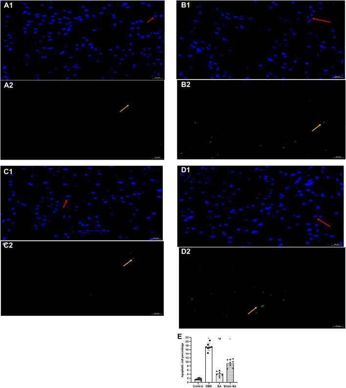 https://cdn.ncbi.nlm.nih.gov/pmc/blobs/09fa/9868671/a1ef104c4102/fphys-13-1008269-g007.jpg