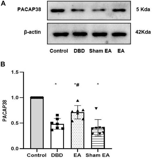 https://cdn.ncbi.nlm.nih.gov/pmc/blobs/09fa/9868671/cf2fa9c3a41f/fphys-13-1008269-g009.jpg