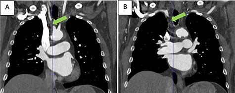 https://cdn.ncbi.nlm.nih.gov/pmc/blobs/09fe/8297644/df6328b905d1/omab048f1.jpg